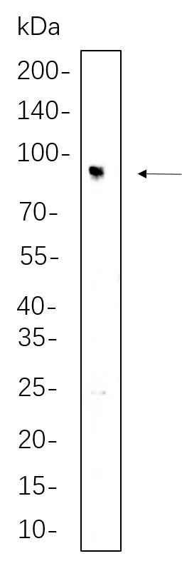 Anti-Human/Mouse/Rat IFT88 Antibody [B645] - ABMIUM