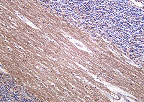 Anti-Human/Mouse/Rat Neurofilament Antibody [B1051] - ABMIUM