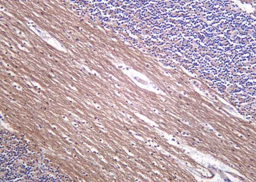 Anti-Human/Mouse/Rat Neurofilament Antibody [B1051] - ABMIUM
