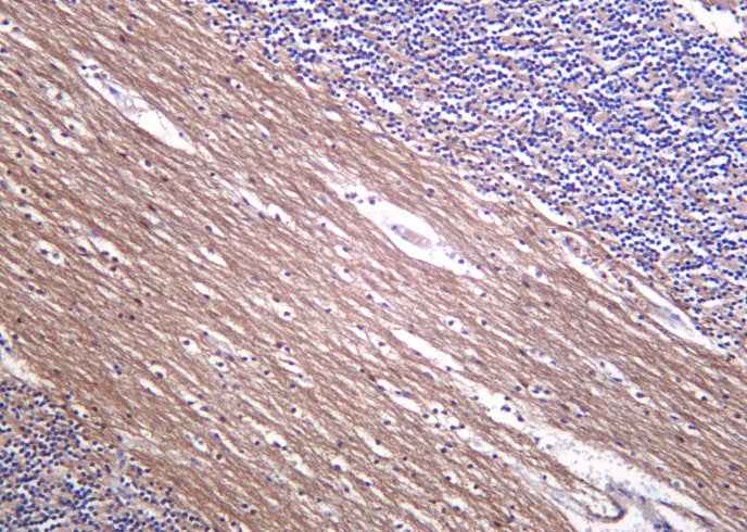 Anti-Human/Mouse/Rat Neurofilament Antibody [B1051]