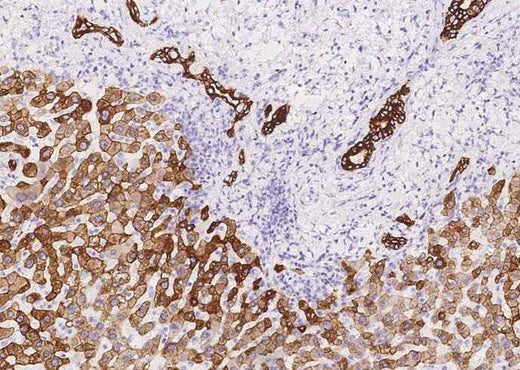 Anti-Human KRT8 Antibody [A1042] - ABMIUM