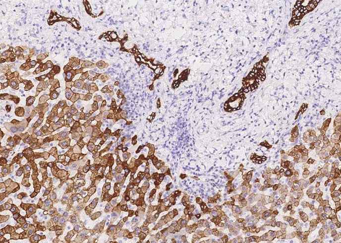 Anti-Human KRT8 Antibody [A1042] - ABMIUM