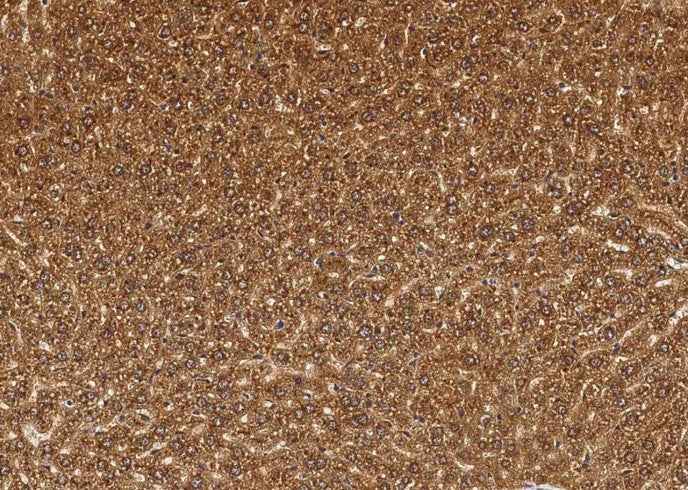 Anti-Mouse CTSB Antibody [B396] - ABMIUM