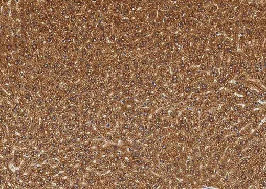 Anti-Mouse CTSB Antibody [B396] - ABMIUM