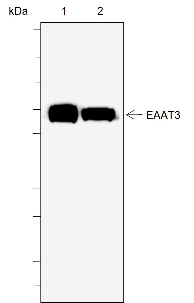 Anti-Human EAAT3 Antibody [A729] - ABMIUM