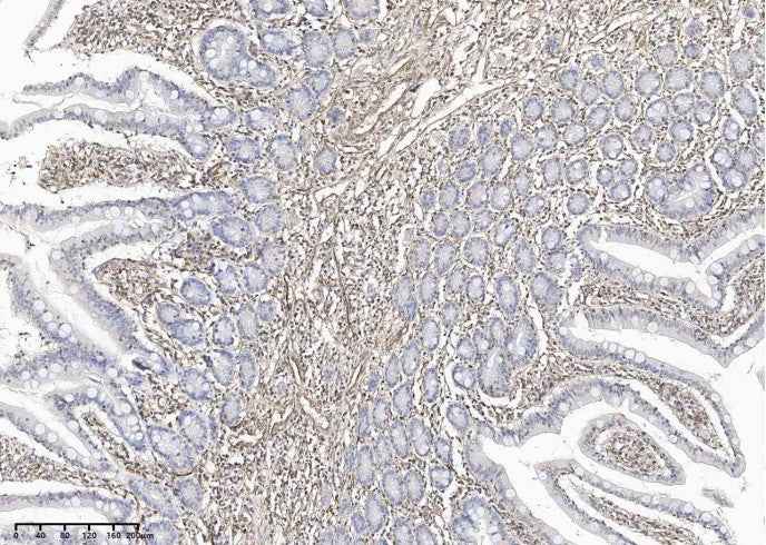 Anti-Human VIM Antibody [B212] - ABMIUM