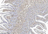 Anti-Human VIM Antibody [B212]