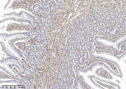 Anti-Human VIM Antibody [B212] - ABMIUM