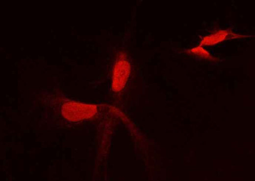 Anti-Human PFDN2 Antibody [A1093] - ABMIUM