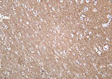 Anti-Human/Mouse/Rat Trk A Antibody [B1050]