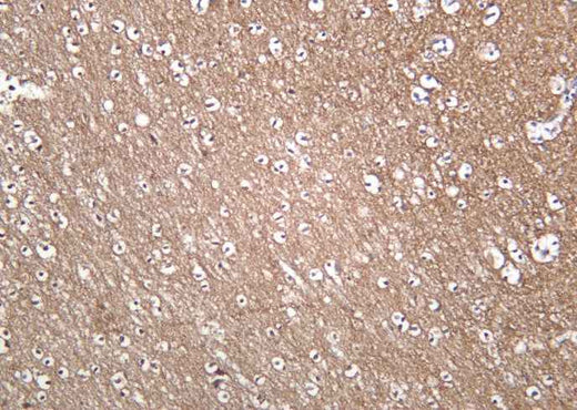 Anti-Human/Mouse/Rat Trk A Antibody [B1050] - ABMIUM