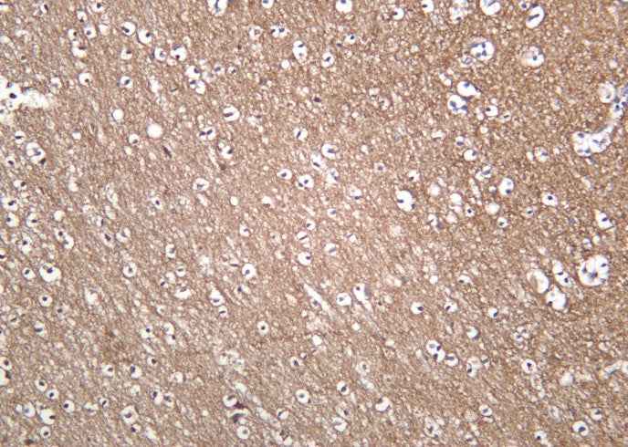 Anti-Human/Mouse/Rat Trk A Antibody [B1050]