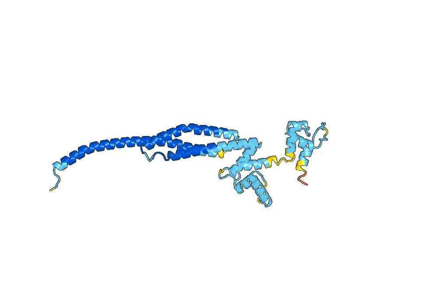 Anti-ACTN4 Polyclonal antibody