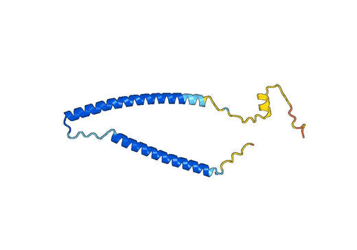 Anti-TNNI1 Polyclonal antibody