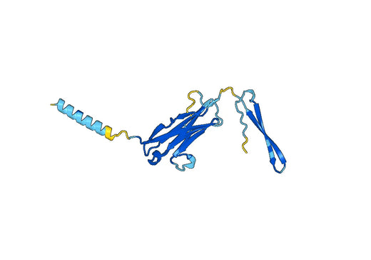 IL1RL1 / ST2, N-His, recombinant protein