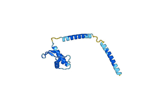 RARS1, N-His, recombinant protein