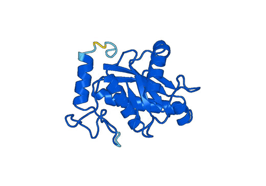 Recombinant Human ADAM28 Protein, N-His