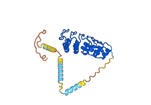 Recombinant Human ANKRD1, N-His