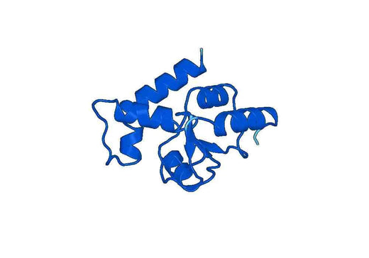 Recombinant Human ARFGAP1 Protein, N-His