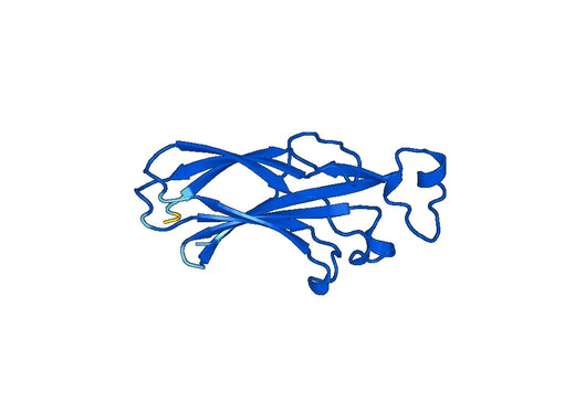 Recombinant Human ASF1A Protein, N-His