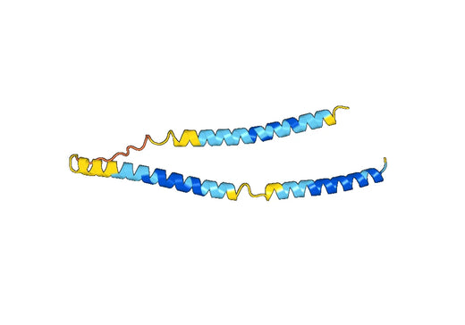 Recombinant Human CALD1 Protein, N-His