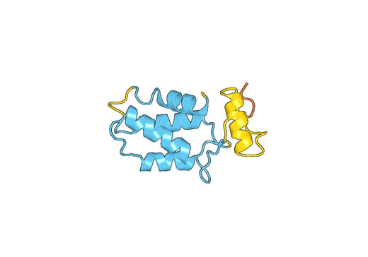Recombinant Human CCPG1 Protein, N-His