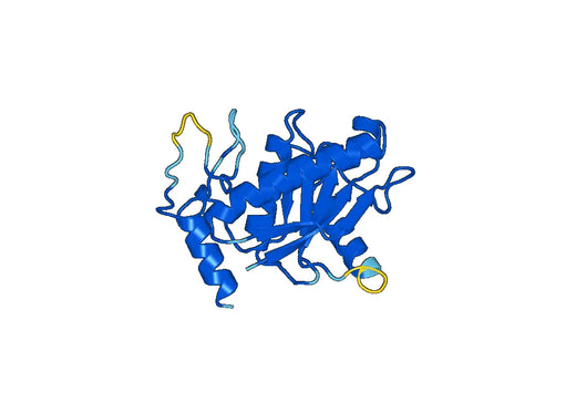 Recombinant Human CD156a/ADAM8 Protein, N-His