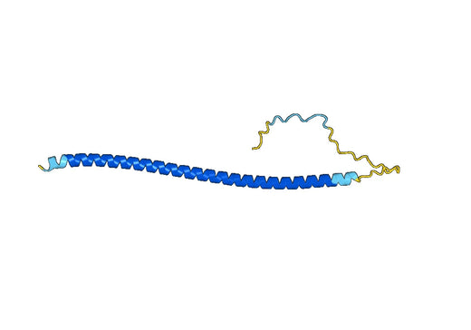 Recombinant Human CEP135 Protein, N-His