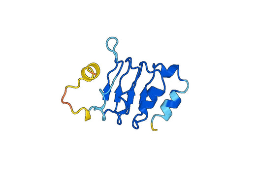 Recombinant Human CEP72 Protein, N-His