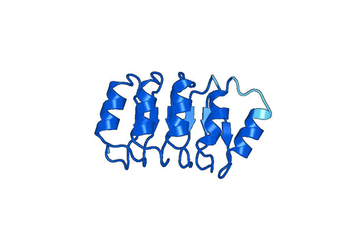 Recombinant Human CMIP Protein, N-His