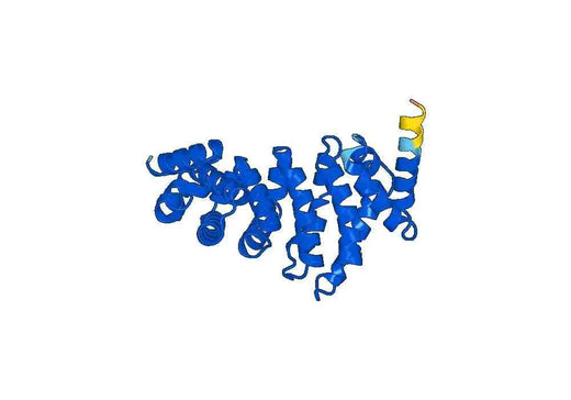 Recombinant Human CNOT9 Protein, N-His
