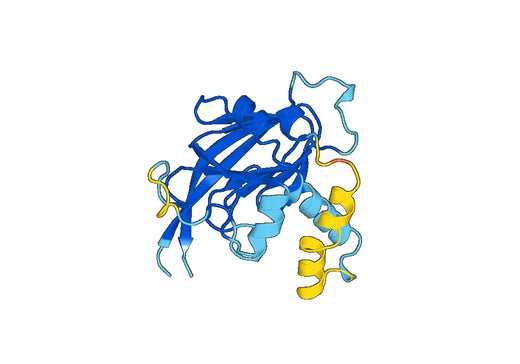 Recombinant Human DGKZ Protein, N-His-SUMO
