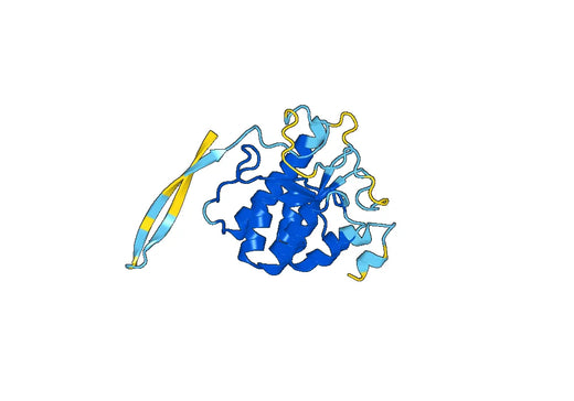 Recombinant Human DIS3 Protein, N-His