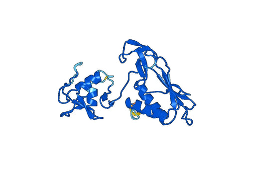 Recombinant Human DTX4 Protein, N-His