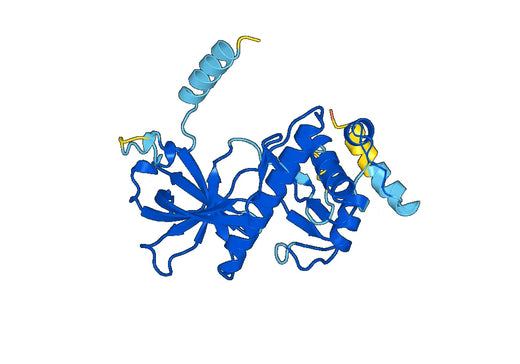 Recombinant Human EEF2K Protein, N-His