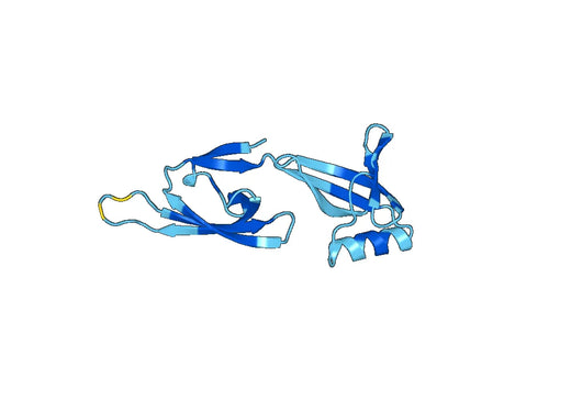 Recombinant Human EIF5A2 Protein, N-His