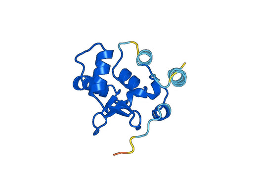 Recombinant Human ETS1 Protein, N-His