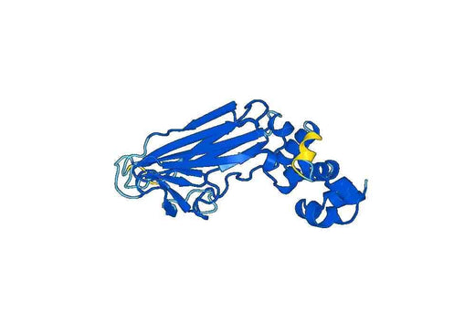 Recombinant Human FBXO17 Protein, N-His