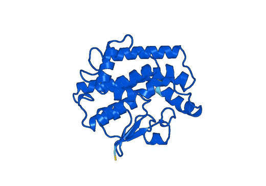 Recombinant Human GSTT1 Protein, N-His