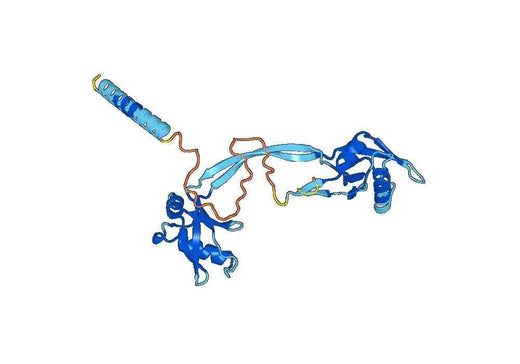 Recombinant Human IFI35, N-His