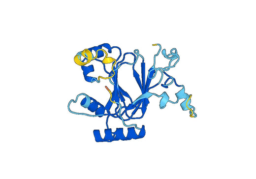Recombinant Human KDM5D Protein, N-His