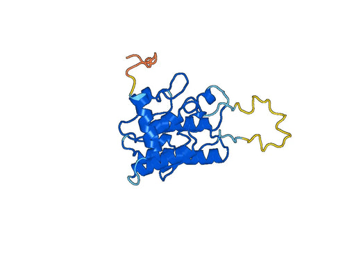 Recombinant Human LIMK1 Protein, N-His