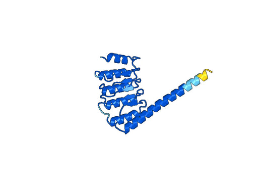 Recombinant Human LMOD1 Protein, N-His
