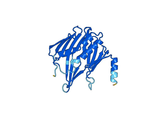 Recombinant Human OSBPL2 Protein, N-His