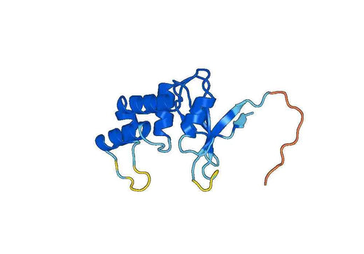 Recombinant Human OTUD6A Protein, N-His