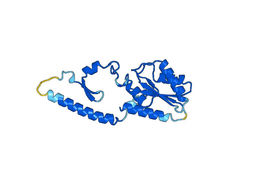 Recombinant Human PFKP, N-His