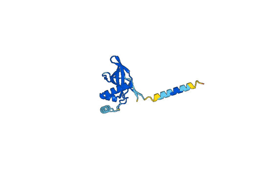 Recombinant Human PIH1D1 Protein, N-His