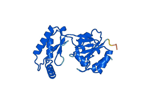 Recombinant Human PMM2 Protein, N-His