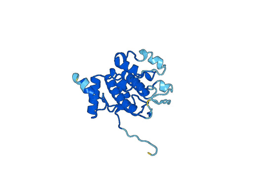 Recombinant Human PRKD1, N-His