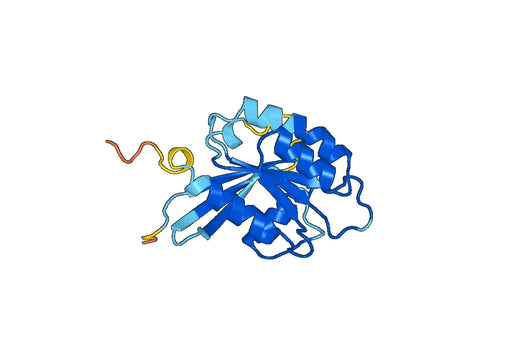 Recombinant Human RAB18 Protein, N-His